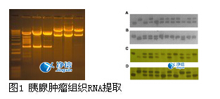 高通量組織研磨儀研磨胰腺腫瘤提取RNA的實驗步驟